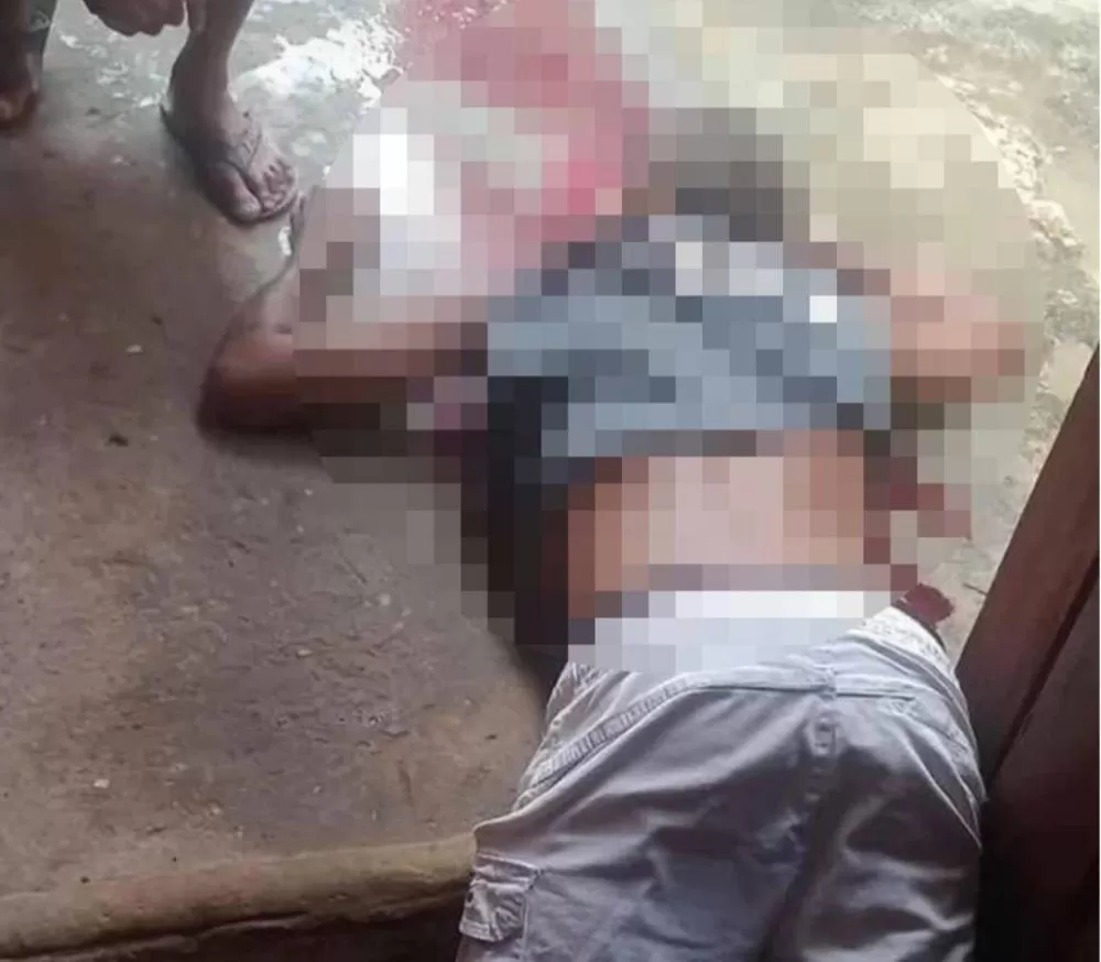 Jovem é assassinado a tiros durante confraternização no bairro Bela Vista, em Caxias.